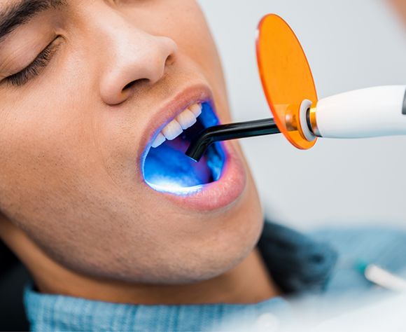 Male patient receiving dental bonding