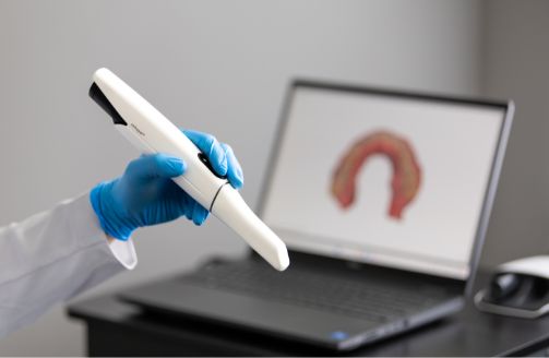 Gloved hand holding intraoral camera