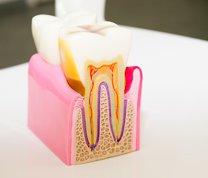 Model showing inside of tooth